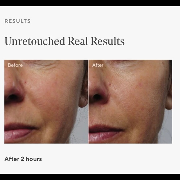 Murad Rapid collagen infusion - Picture 6 of 6